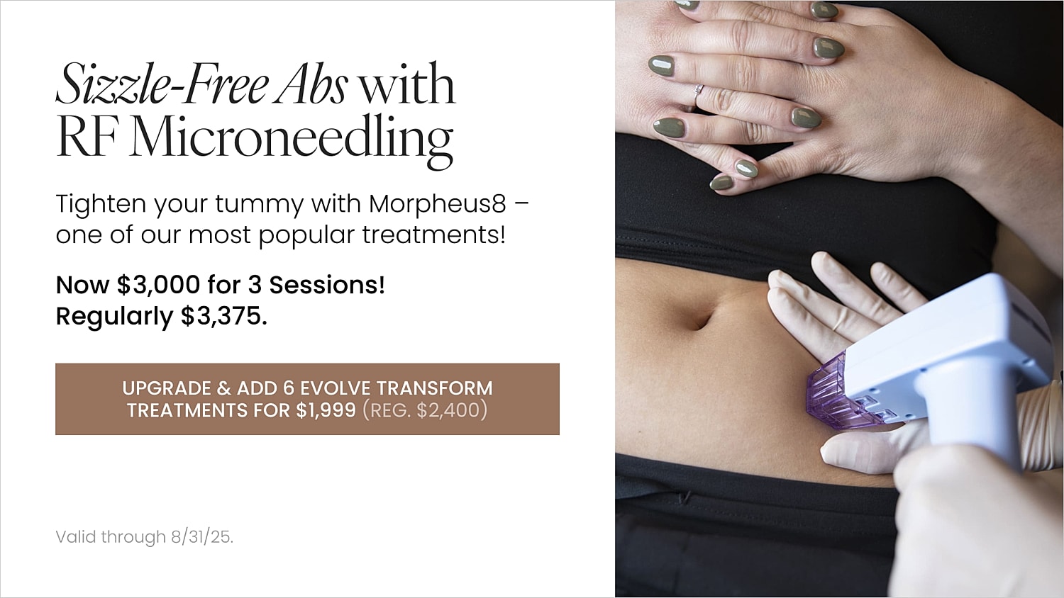 RF microneedling treatment for abdominal tightening.