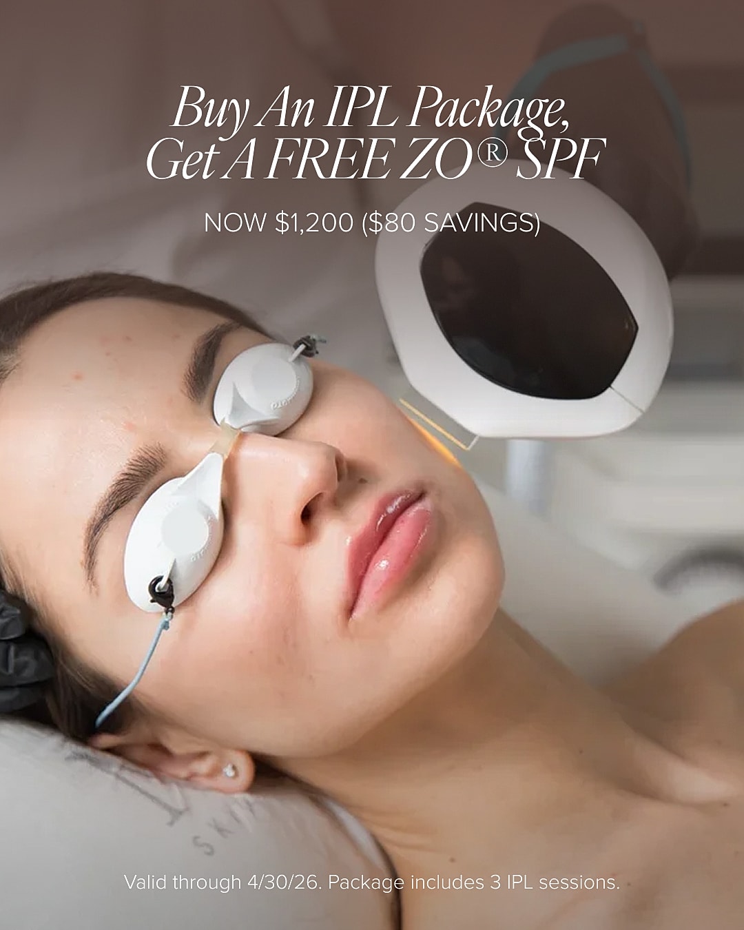 IPL treatment promotion with free SPF offer.